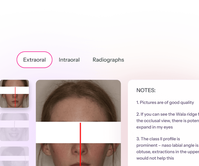 Specialist Annotations